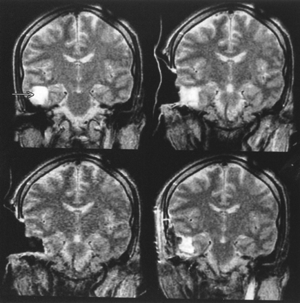 fig 6.