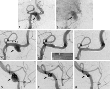 fig 3.