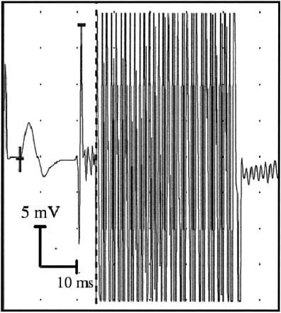 fig 1.
