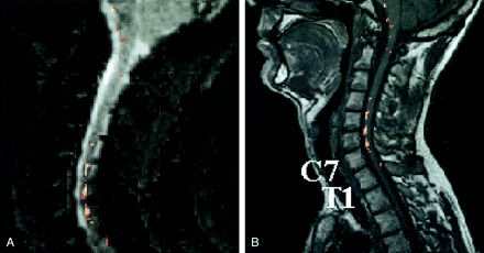 fig 3.