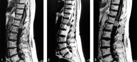 fig 1.