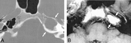 fig 2.