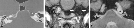 fig 5.