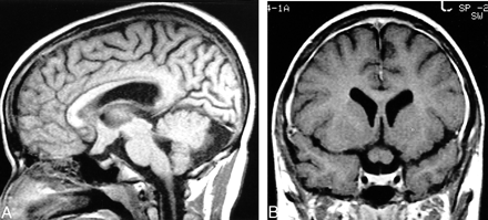fig 1.