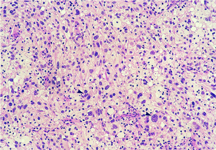 fig 3.