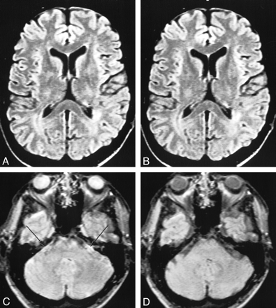 fig 4.