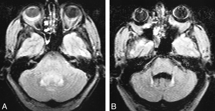 fig 6.