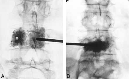 fig 4.