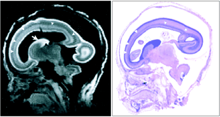 fig 1.