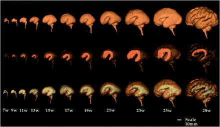 fig 3.