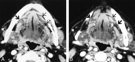 fig 2.