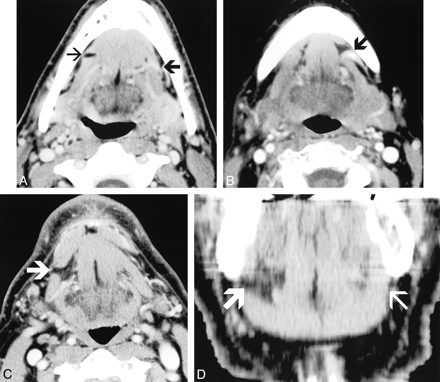 fig 4.