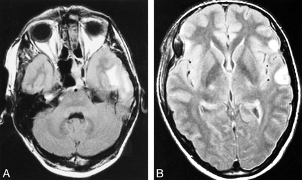 fig 1.