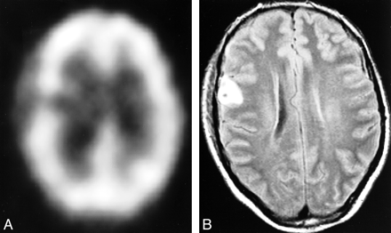 fig 3.