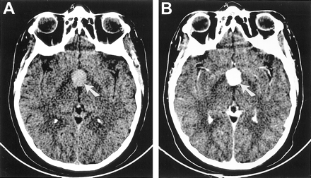 fig 2.