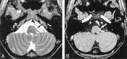 fig 2.