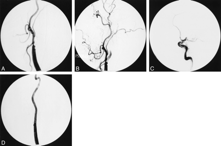fig 1.