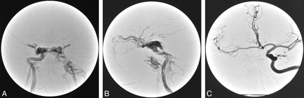fig 1.