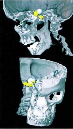 fig 2.