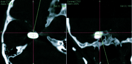 fig 3.