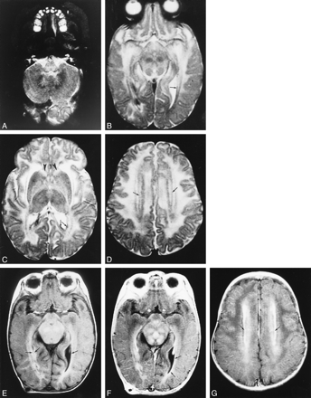 fig 1.