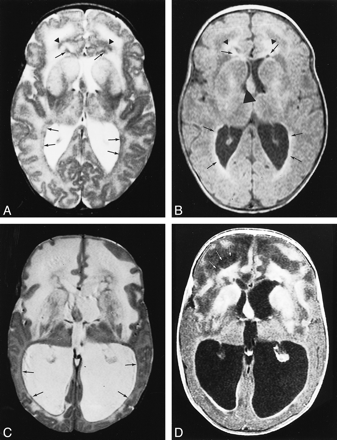 fig 3.