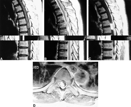 fig 2.