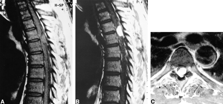 fig 3.