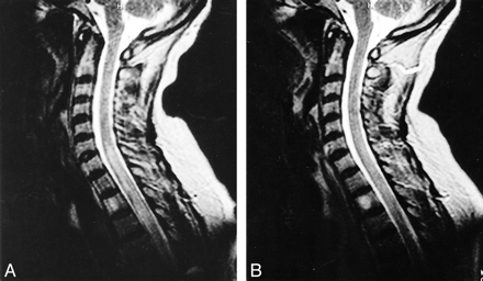 fig 2.