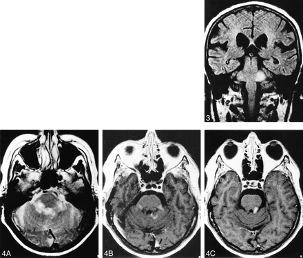 fig 3.
