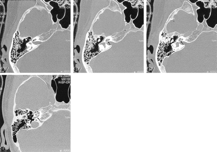 fig 1.