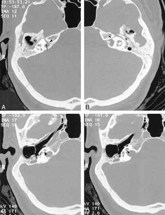 fig 2.