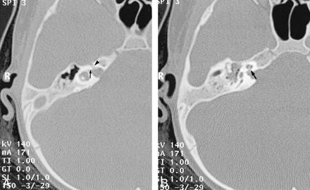 fig 3.