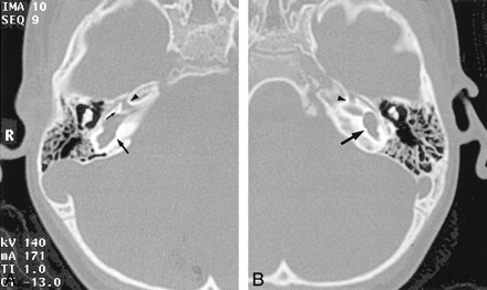 fig 4.