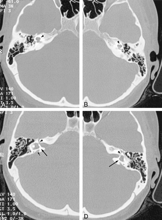 fig 5.