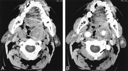 fig 1.
