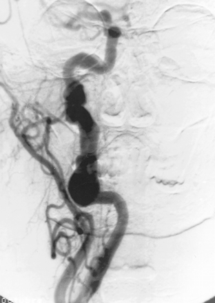 fig 3.