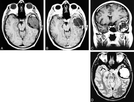 fig 1.