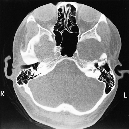 fig 3.
