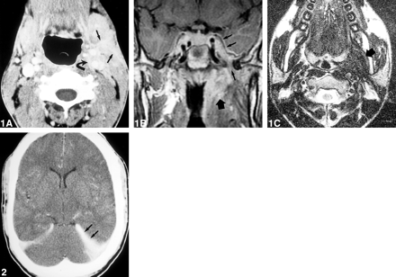fig 1.
