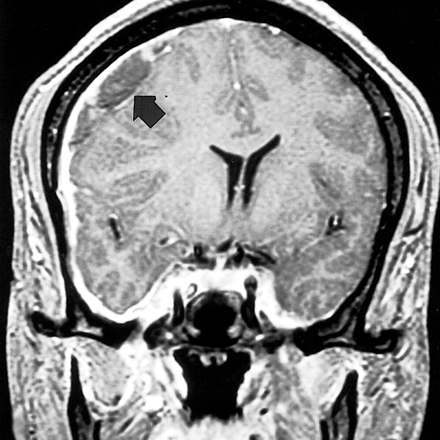 fig 4.