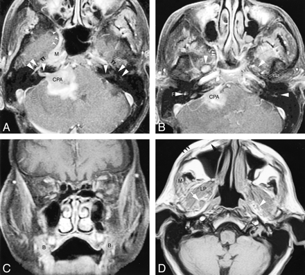 fig 2.