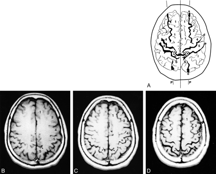fig 3.