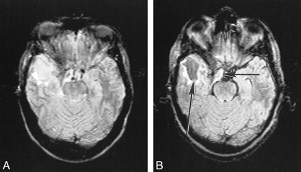 fig 8.