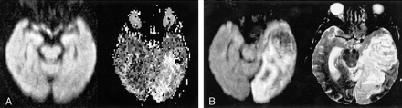 fig 1.