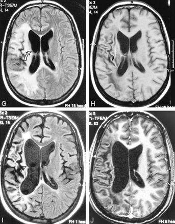 fig 1.