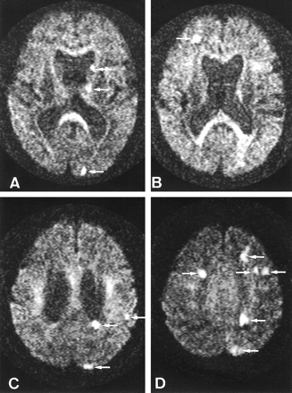 fig 2.