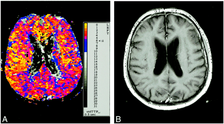 fig 2.