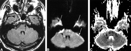 fig 4.