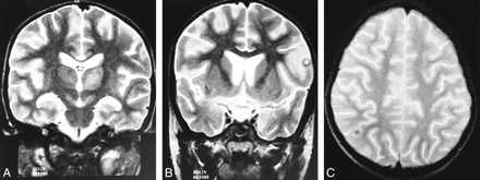 fig 4.